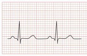 electrocardiograma ecg caba capital federal ciudad autonoma de buenos aires belgrano