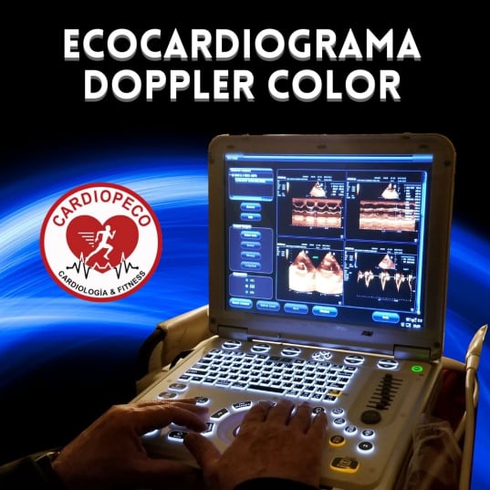 Ecocardiograma doppler color