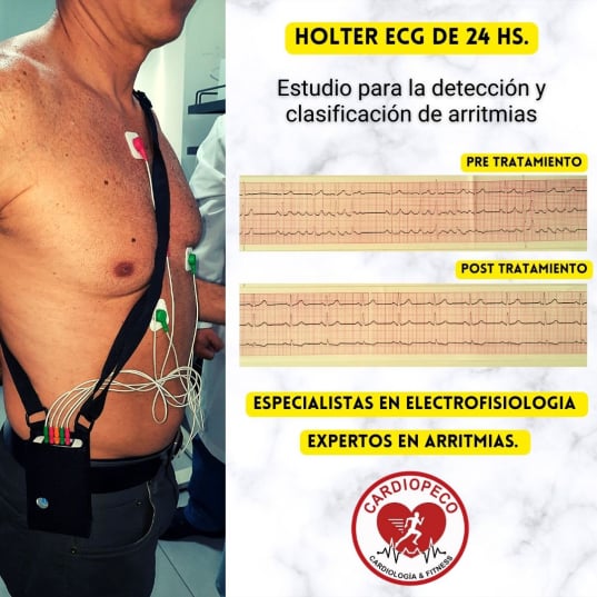 holter ecg monitor cardiaco caba capital federal ciudad autonoma de buenos aires belgrano