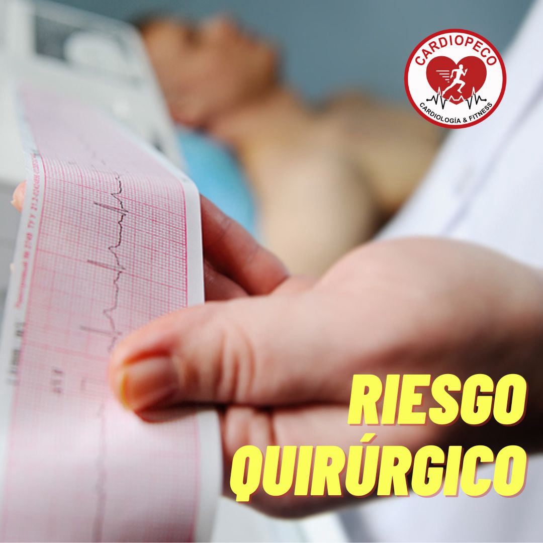 riesgo quirurgico prequirurgico ecg con informe electrocardiograma